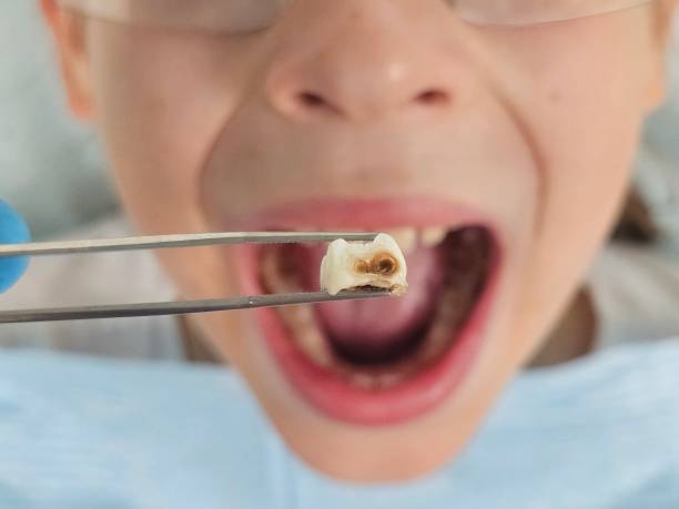 Best Emergency Dental Care for Trauma or Injury in Corte Madera, CA